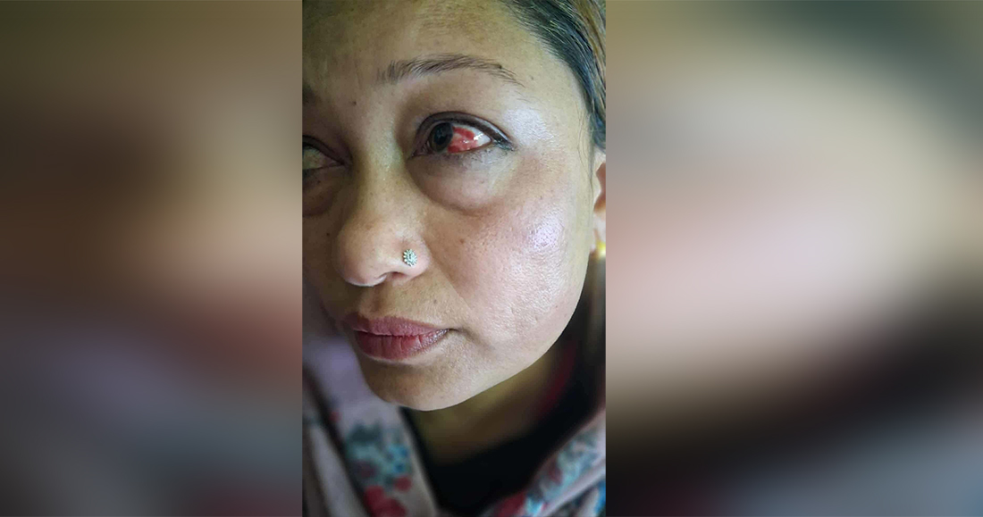 विद्यालयमा हिंसा: शिक्षाको मर्यादामा दाग